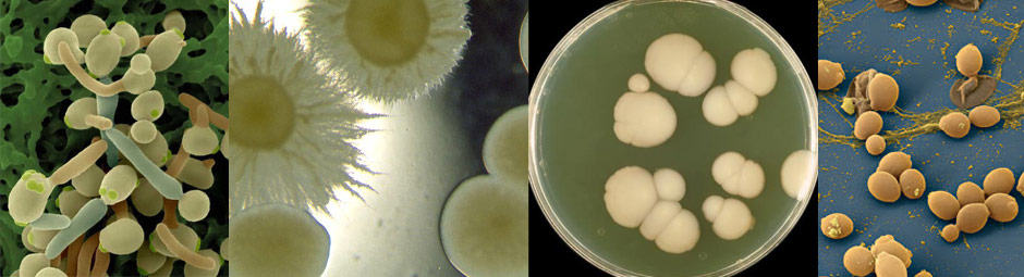 Candida albicans