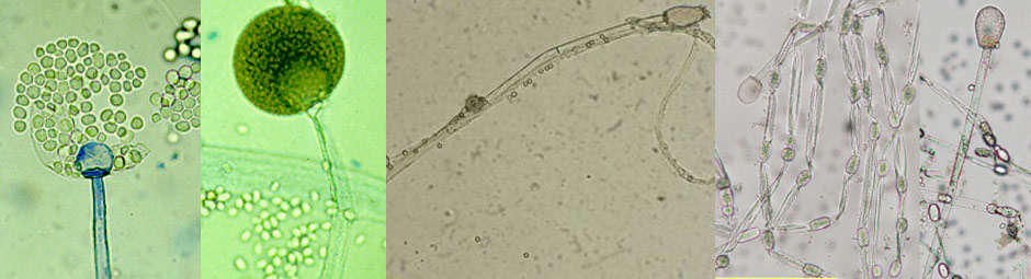 Mucor racemosus